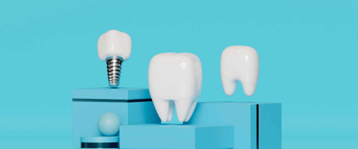 dental implant