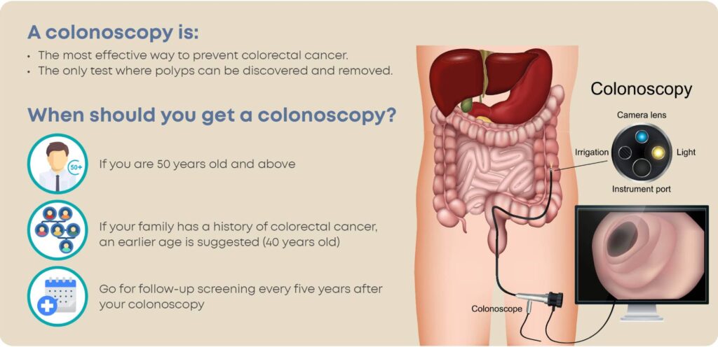 Diagram explaining what is colonoscopy