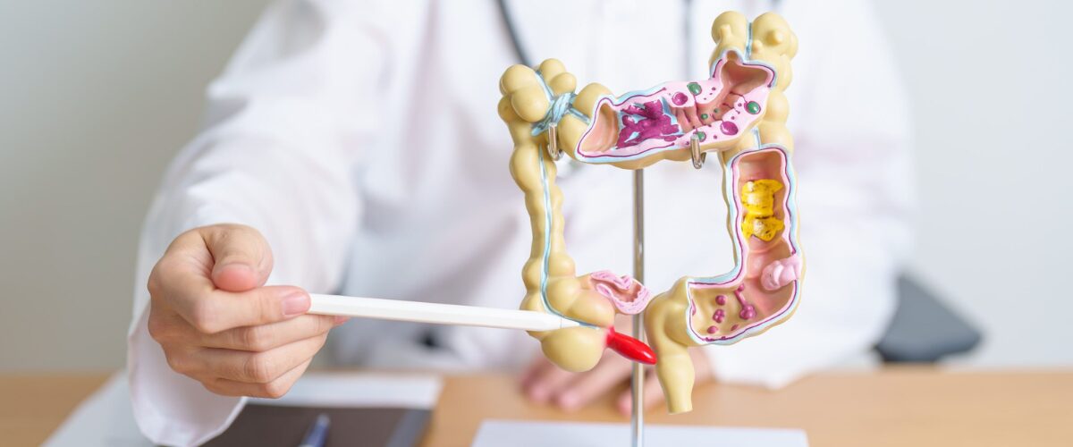 Doctor Showing Colonoscopy Procedure