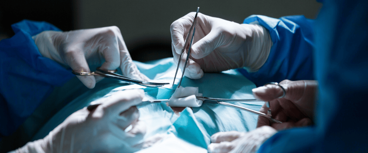 Laparoscopic Surgery featured image