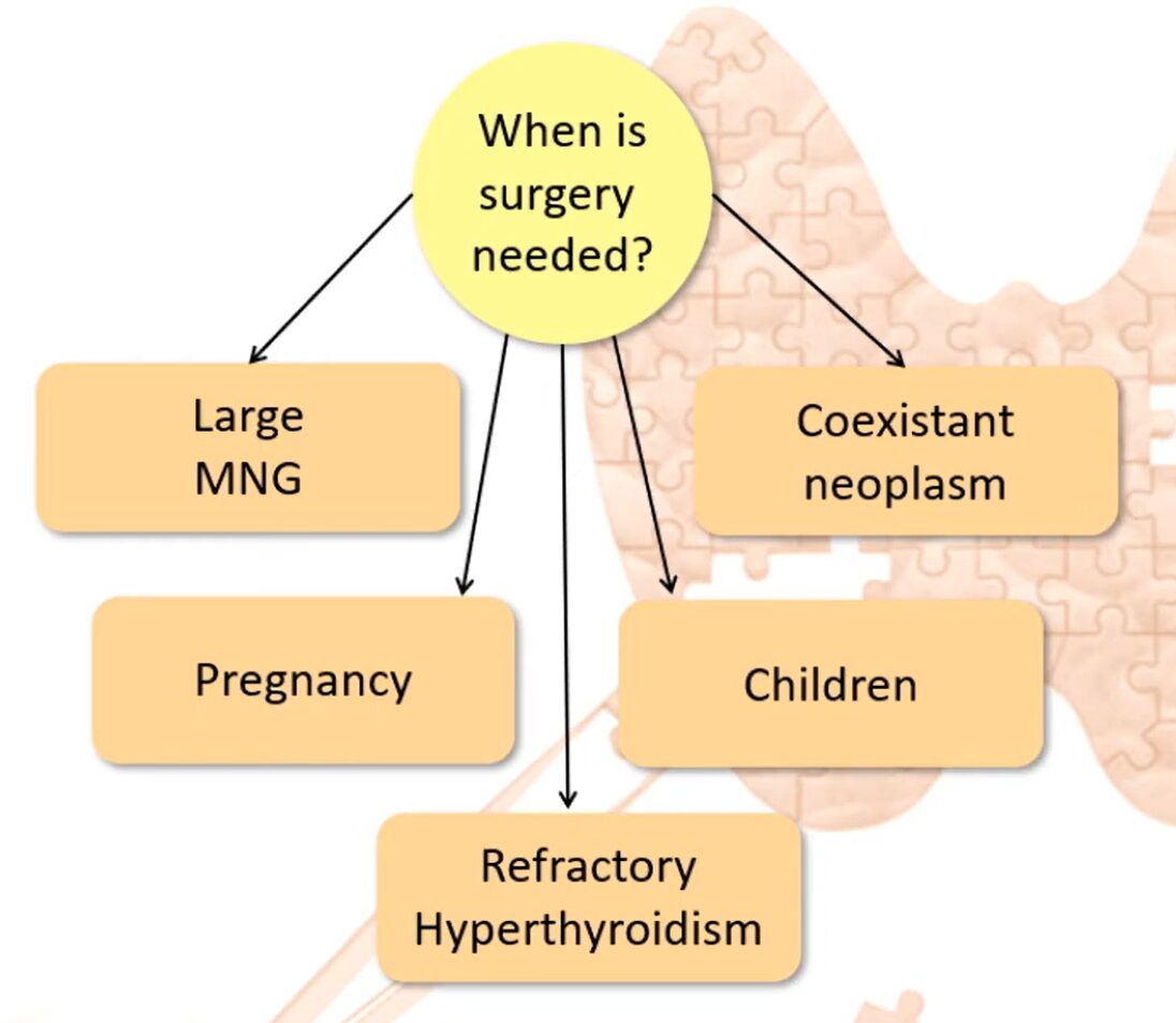 Diagram for When is surgery needed